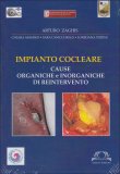 Impianto Cocleare  — Libro